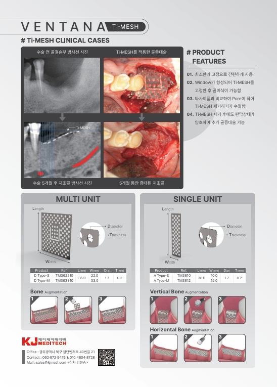 catalog 이미지